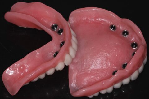 dentures